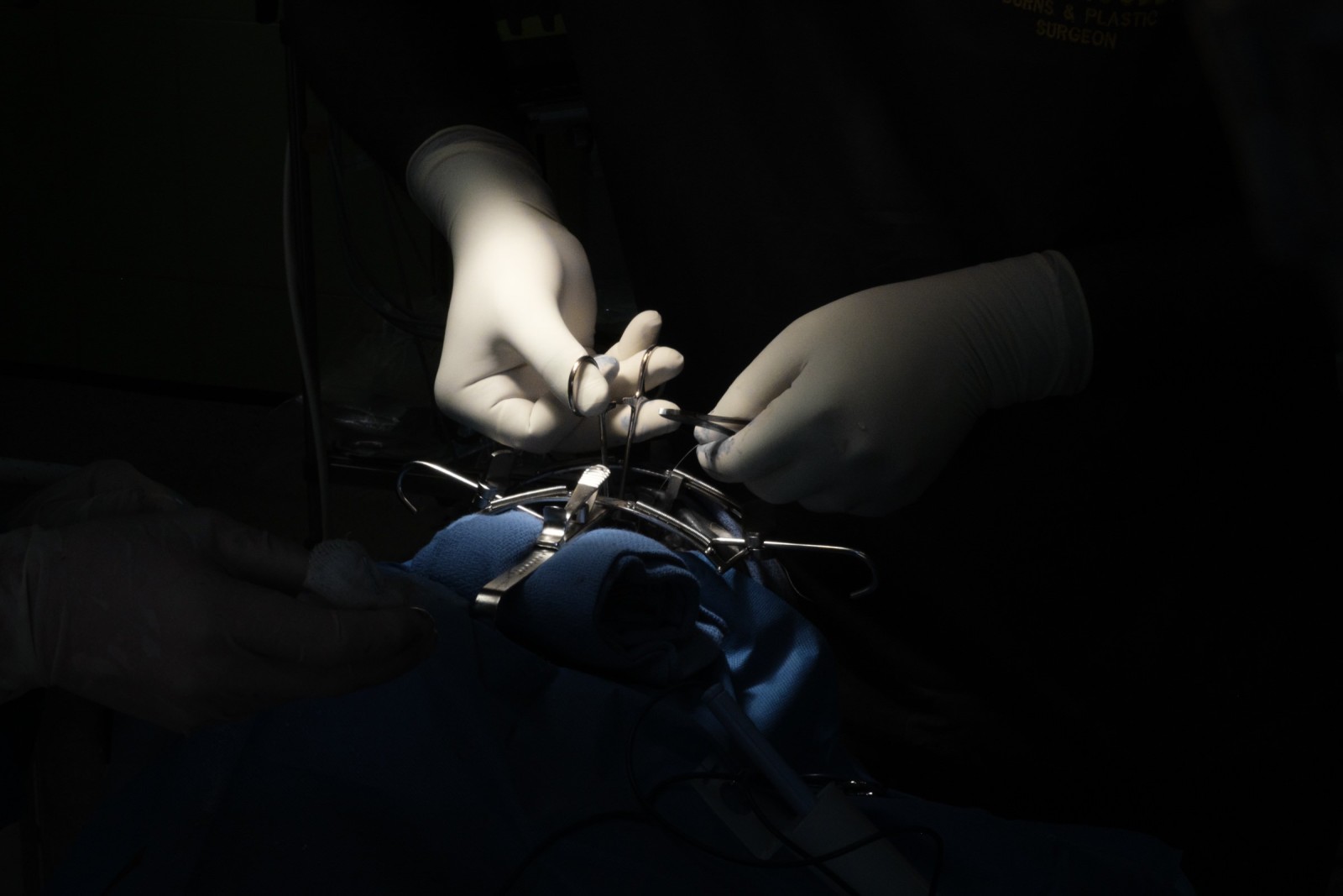 Documentary photograph from the Alliance for Smiles cleft-care mission in Lagos, Nigeria, by Mattia Compagnucci